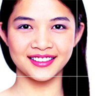 Microdermabrasion