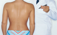 Breast reduction surgery
